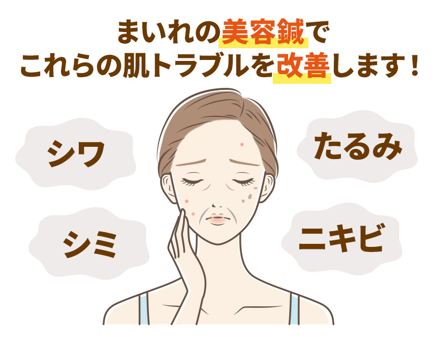美容鍼改善
