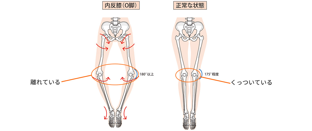 膝痛はなぜ起こるの?